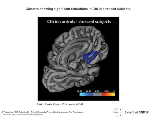 Blue cluster shows significant reductions in Cth in stressed subjects. The calculation is corrected for age and gender. The projection of cerebral hemispheres (MR images of the Freesurfer atlas) is standardized. Scale is logarithmic and shows –log10(P). Warm colors indicate positive contrasts (higher values in stressed subjects), cool colors negative contrasts (lower values in stressed subjects). Reproduction from Savic I. 2013, Cerebral Cortex bht348.