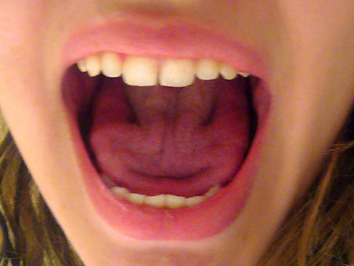 smile!