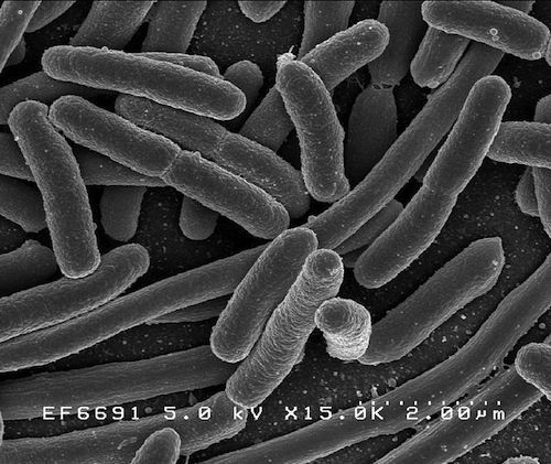 EColi_NIAID.jpg