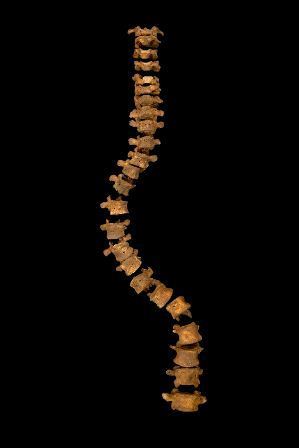 Richard spine