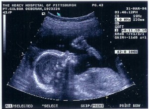 babynumber2at20weeks 300x221 Breastfeeding is Hard!