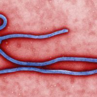 Colorized Ebola Virus (by Cynthia Goldsmith)