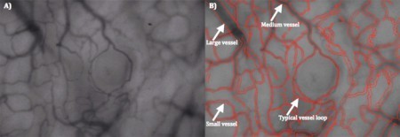 nasal_mucosa_reindeer_1