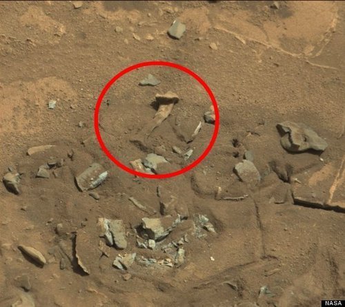 shin bone?