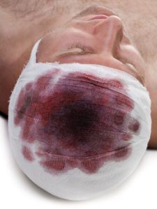 Bandage on human brain concussion