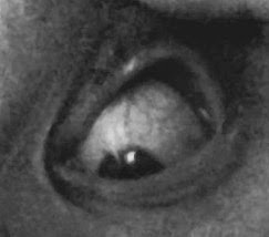 flash_fiction_horror_eye