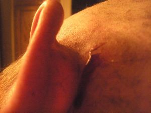 EXTREME BLOOD
