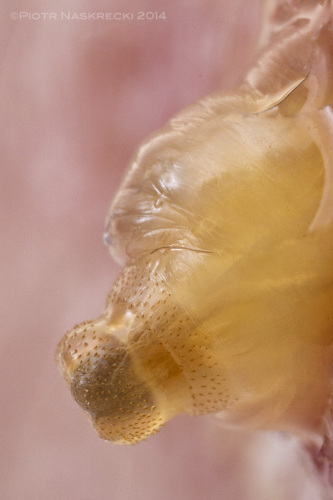 That's a nice-looking butt – I knew that something was amiss when a strange tube started poking out of my skin. This turned out to be a bot fly's breathing tube.