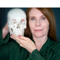 Pamela Shauvan Scott, with a 3D printed copy of her own skull. Her right index finger is indicating the former location of the meningioma she had removed.