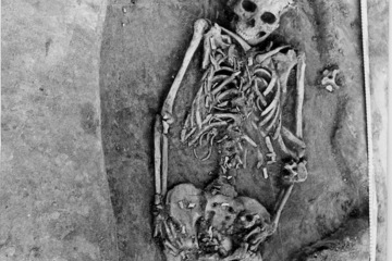 mother and twins skeletons