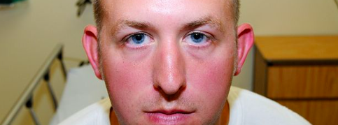 Darren Wilson bruises
