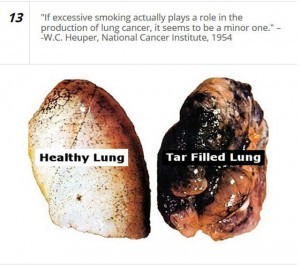 lung cancer