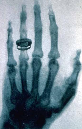 Bertha Roentgen���s hand