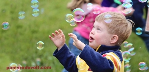 Down_syndrome-8.jpg
