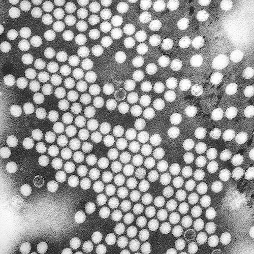 Polio_EM_PHIL_1875_lores.jpg