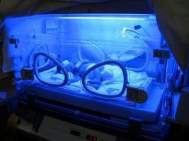 Bilirubin lights turn the incubator blue.