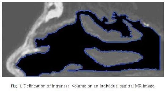 Intranasal-Cavity