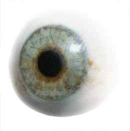 Artificial-Eye