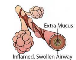 Swollen Bronchii