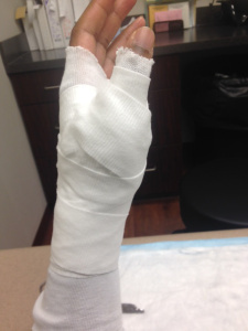 Cast 1