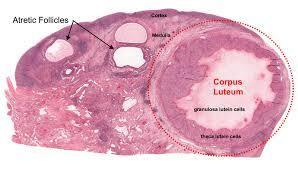 corpus luteum