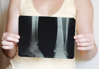 X-ray image of legs