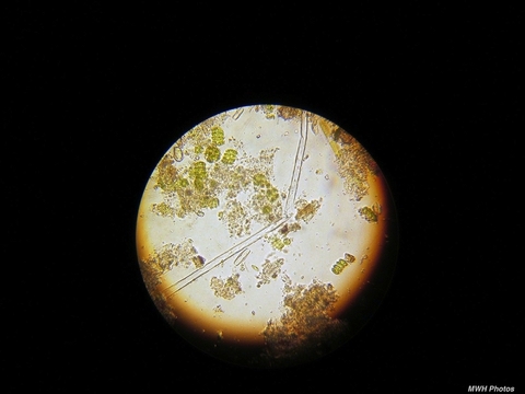 Photo: Microbes, biodiversity and the benefits of getting dirty
