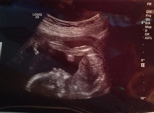 Baby_Time_Ultrasound_Genese_Cora