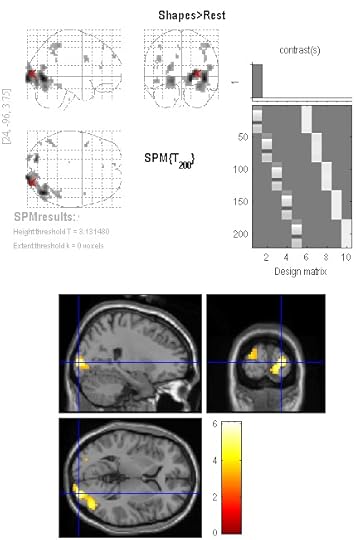 I can tell one shape from another.
