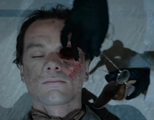 MISS FISHER - no eyeball