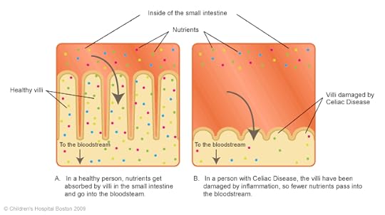 celiac_intestine