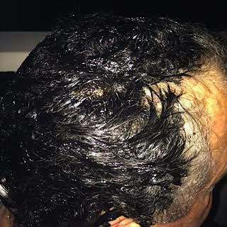 hair with the dye on it
