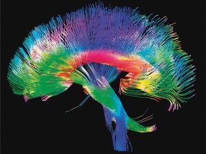 brain connectomics