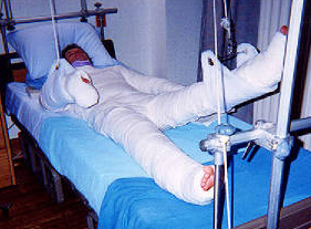 It's all about traction