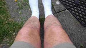 Geoff Nelder's short fat hairy legs