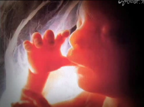 Abortion-Ad