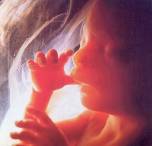 abortion-11-
