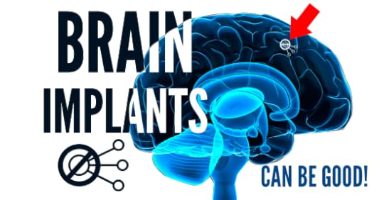 Brain-Implants