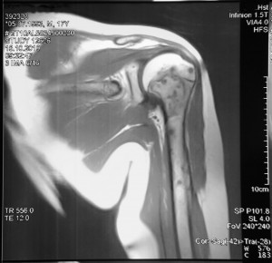 5152277940_155733486f_o