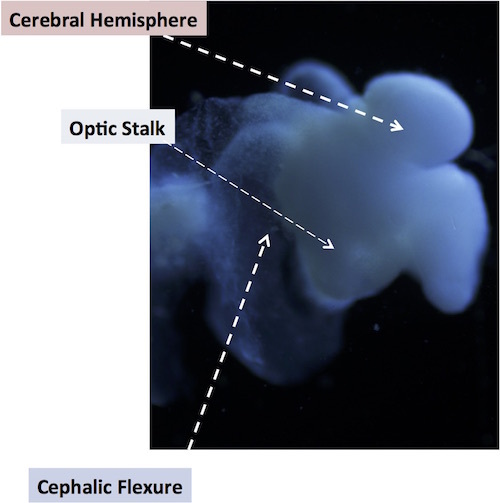 labeled brain organoid.jpg