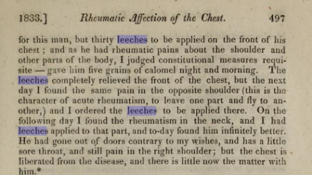 rheumatic fever
