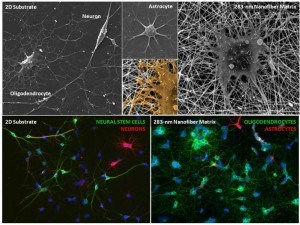 neural matrix fiber topography, Johns Hopkins University