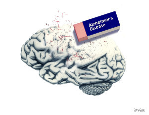 alzheimer__s_disease_by_the_infinite_opi