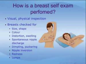 img-breast-self-examination-856