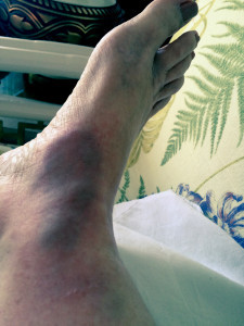 Immediately after fall