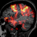 Image from NIH. Click for source.