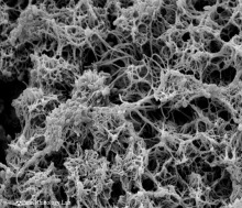 BioFilms in Chronic Rhino Sinusitis U Penn