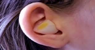 onion in ear