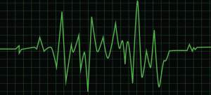EKG
