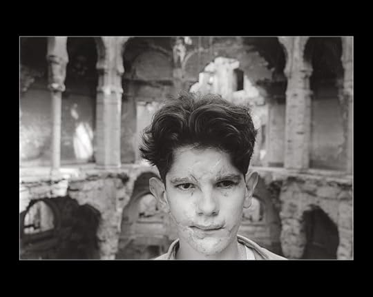 Adis Smajic seis meses después de su accidente en la biblioteca de Sarajevo. Fotografía de Gervasio Sánchez